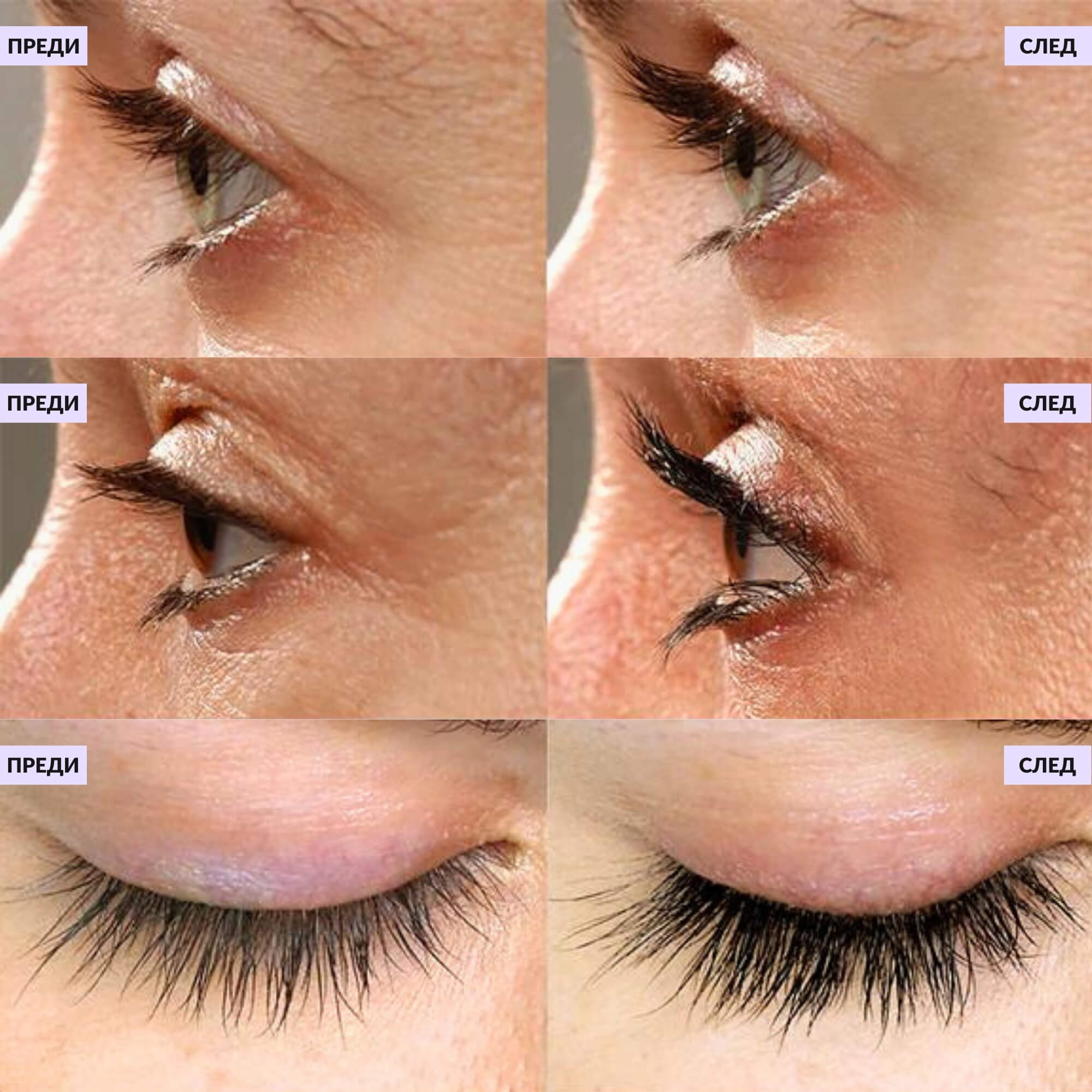 Резултати преди и след използването на серума за мигли Cutisora, показващи увеличена дължина и плътност на миглите при профилен изглед.